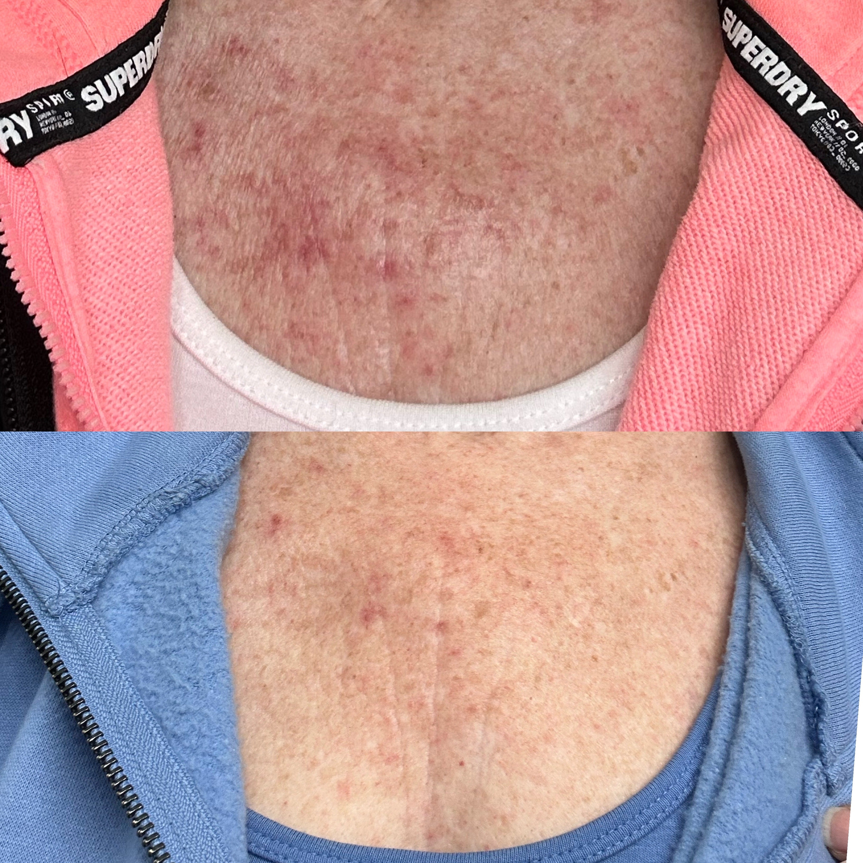 Biome Restore Oil – Barrier Repair & Post-Treatment Recovery for All Skin Types (50mL)