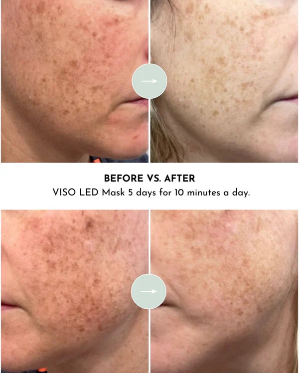 VISO Mask